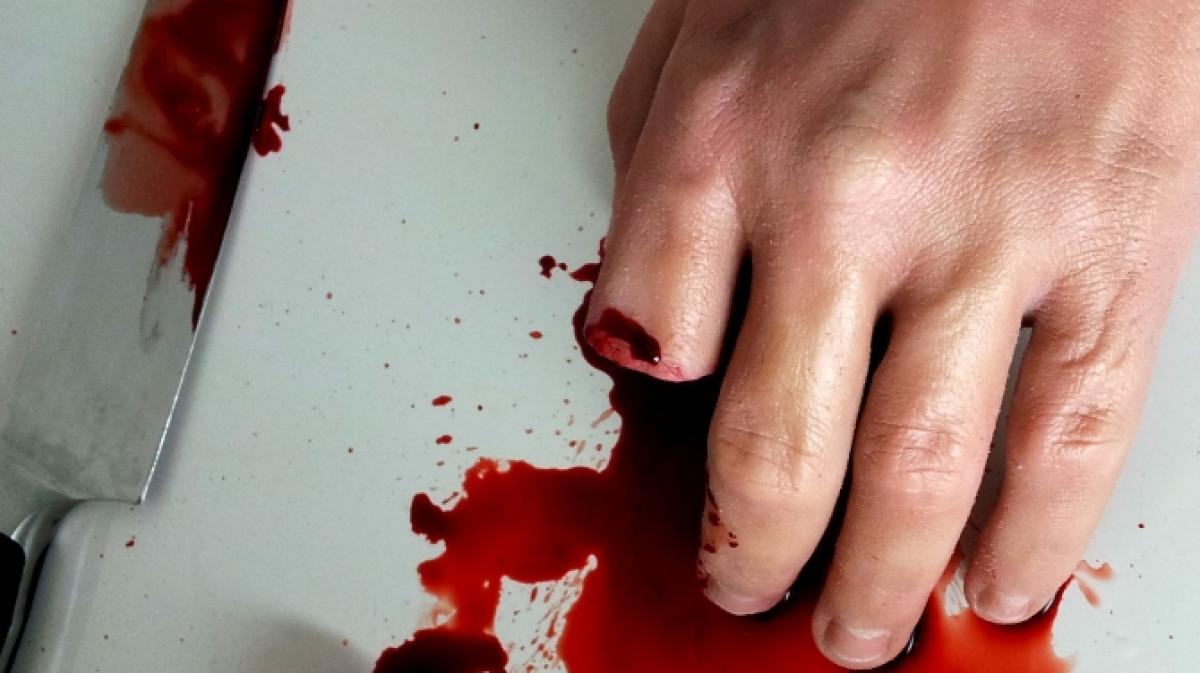 Ein abgeschnittene Finger in Chemnitz und weitere Vorf&auml;lle sorgten jetzt f&uuml;r die Schock-News der Woche. (Symbolbild) (Foto)