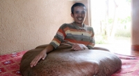 Der krebskranke Vietnamese Nguyen Duy Hai sitzt am 15.06.2011 in seinem Haus in Da Lat (Vietnam) und zeigt seinen Tumor.