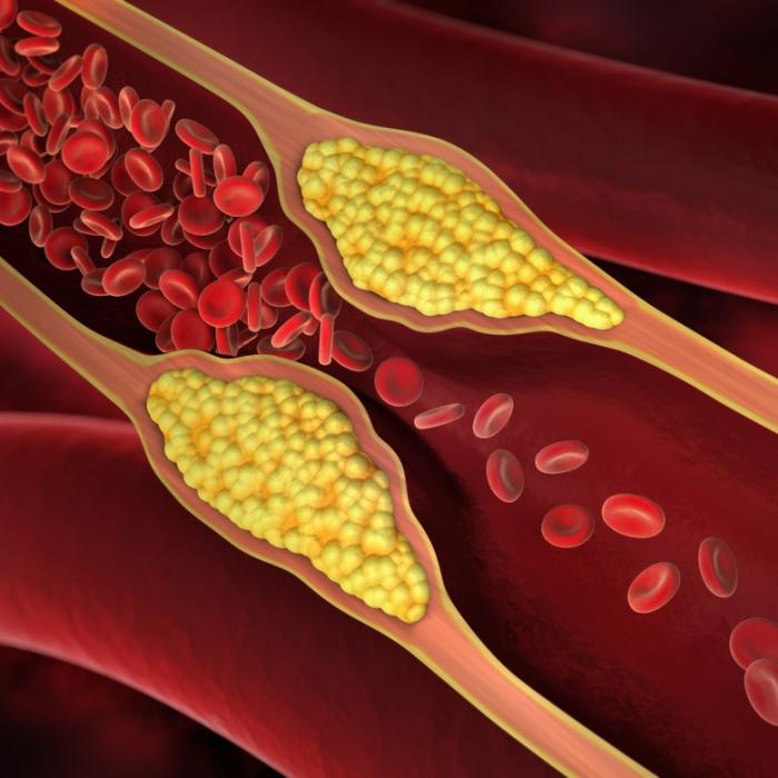 Gewusst? DIESE Lebensmittel wirken cholesterinsenkend