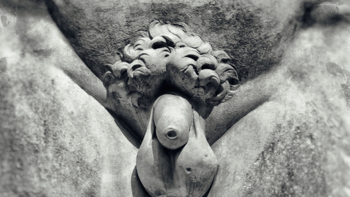 Nach einer H&auml;morrhoiden-OP war der Penis eines Mannes v&ouml;llig verbrannt. (Foto)