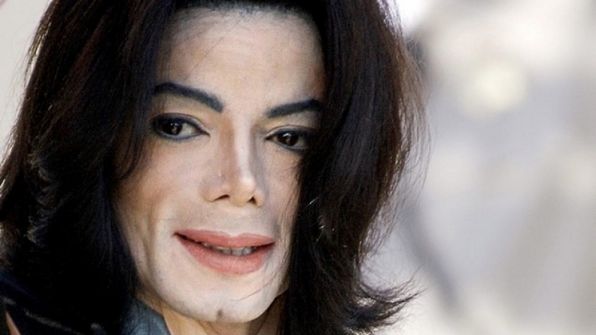 Michael Jacksons Haut wurde immer bleicher. Als Grund nannte er die Wei&szlig;fleckenkrankheit. (Foto)
