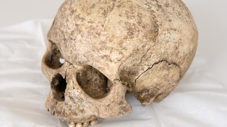 Wie ein skelettierter Schädel auszusehen - das ist der Lebenstraum von Eric Yeiner Hincapie Ramirez aus Kolumbien (Symbolbild).
