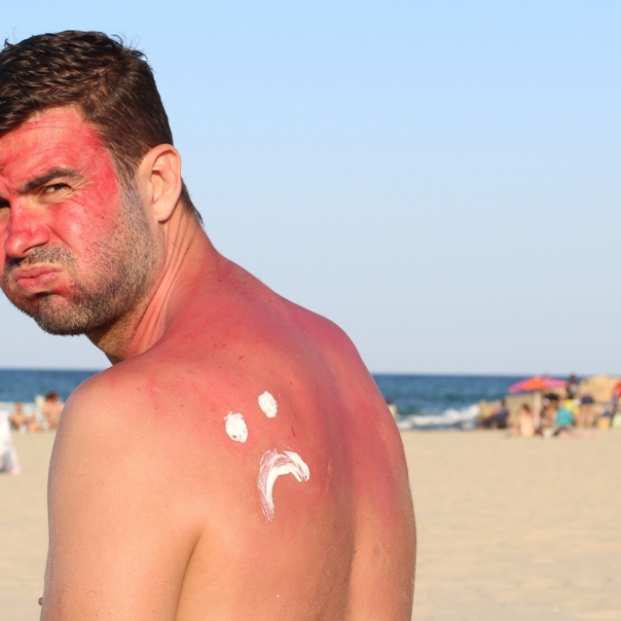 So gefährlich können übermäßige Sonnenbäder sein