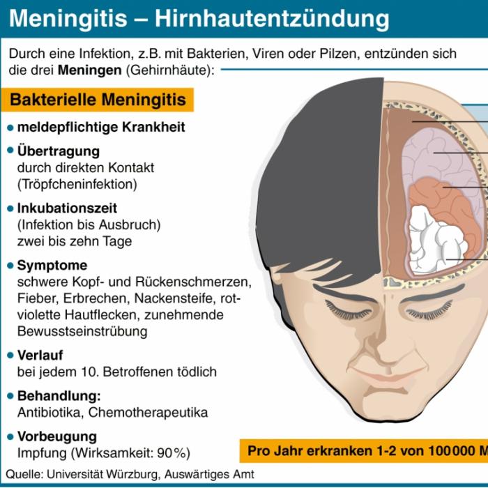 Glas-Test hilft Meningokokken-Infektion erkennen