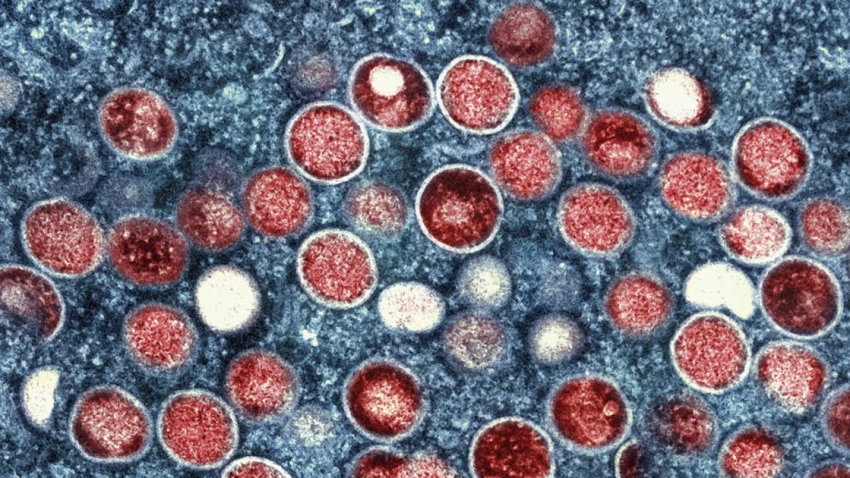 Die Weltgesundheitsorganisation (WHO) hat aufgrund der Affenpocken-Ausbreitung die Notlage ausgerufen. (Foto)