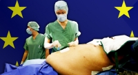 Pro Jahr werden über 344.000 Eingriffe gezählt, davon alleine 220.000 in Nordamerika. In Europa lag Deutschland mit 2117 Fällen hinter Frankreich (13.722), Belgien (8700), Großbritannien (6000), Spanien (6000), Italien (4842), Holland (3500) und Griechenl