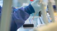 Wissenschaftler haben ein außergewöhnliches Riesenvirus entdeckt.