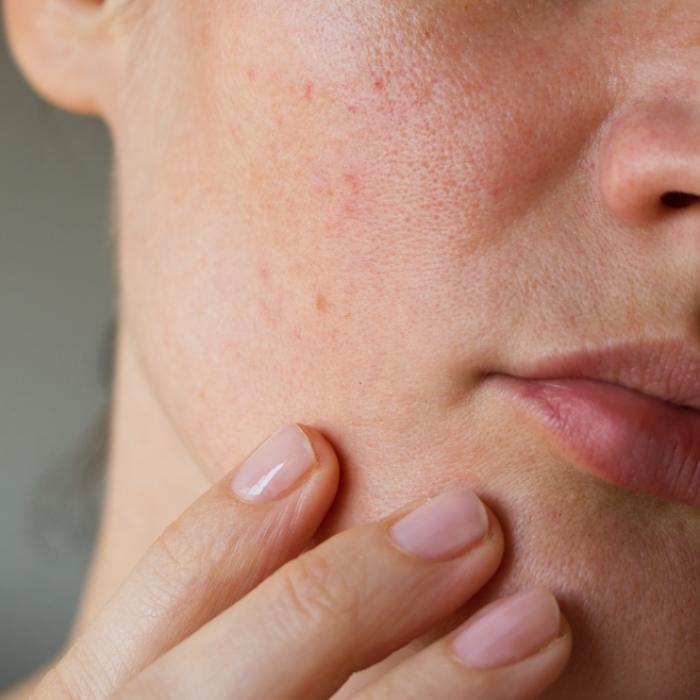 Was die Gesichtshaut über Ihre Gesundheit verrät