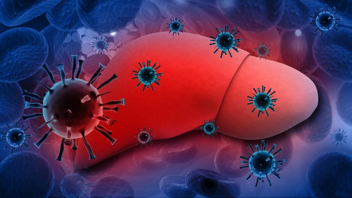 Eine Hepatitis-Infektion kann die Leber angreifen. (Foto)