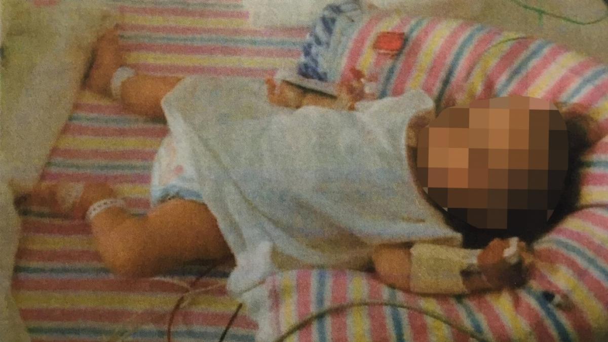 Mit 19 Monaten sah das M&auml;dchen noch immer aus wie ein drei Monate altes Baby. (Foto)