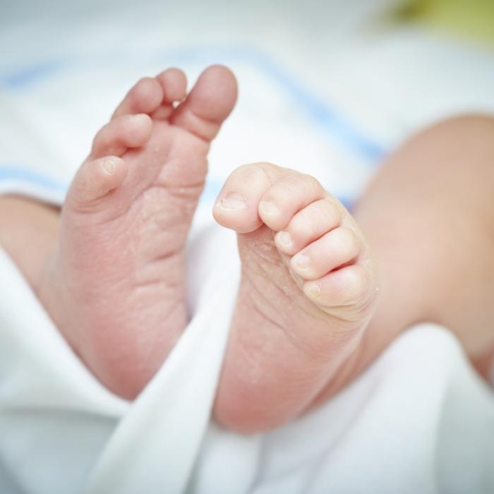 Parasitärer Zwillingskopf! Baby mit zwei Köpfen erstaunt Ärzte