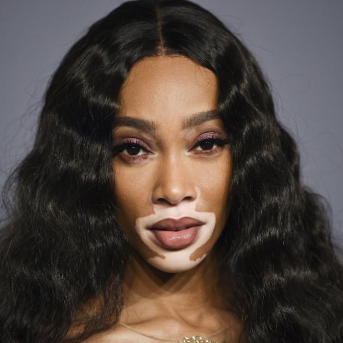 So tickt das Model mit den weißen Flecken