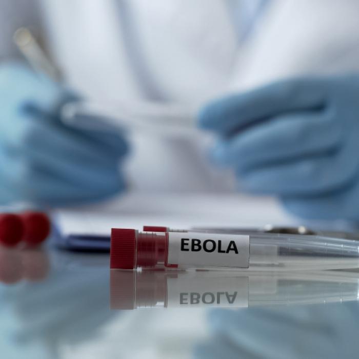Wissenschaftler züchten Killer-Virus - Es tötet in nur von 3 Tagen