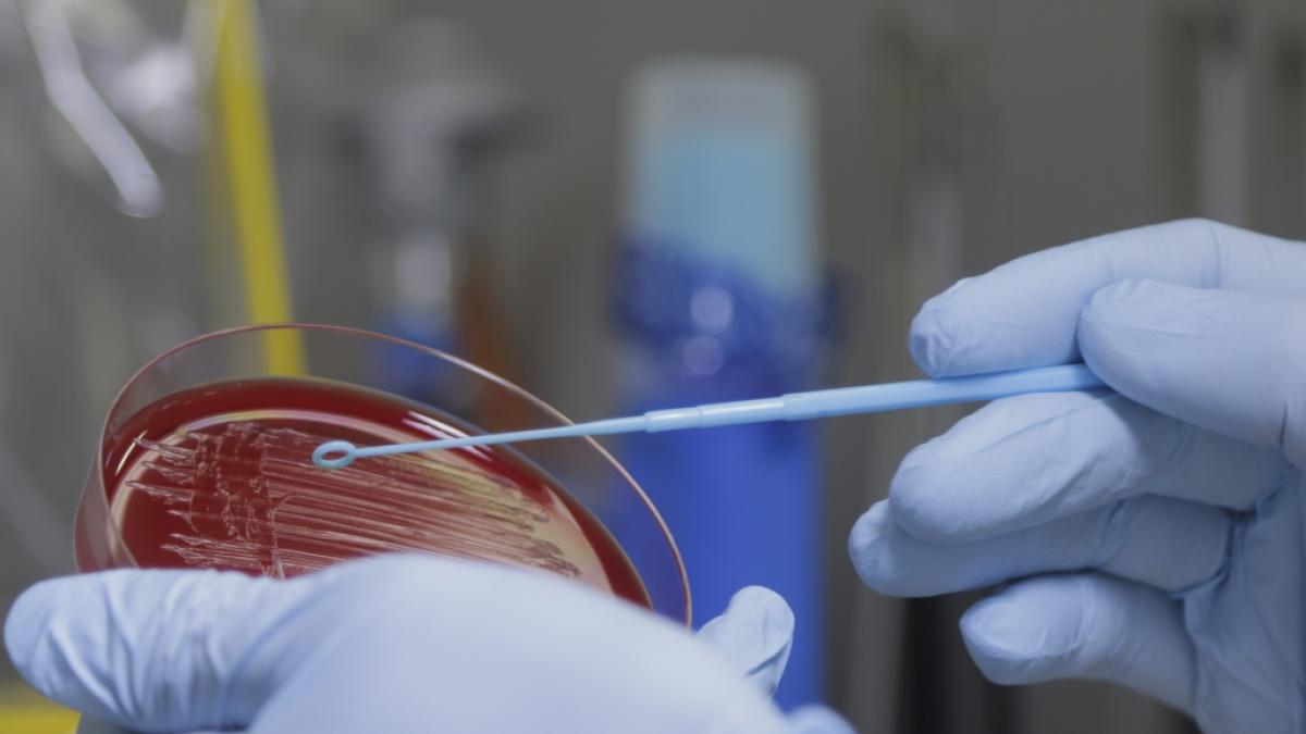 Forscher haben ein Mittel gegen antibiotikaresistente Krankheitserreger gefunden. (Foto)