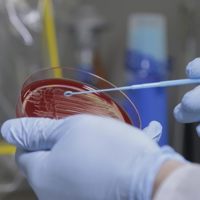 Antibiotikaresistente Erreger könnten 10 Millionen Menschen töten