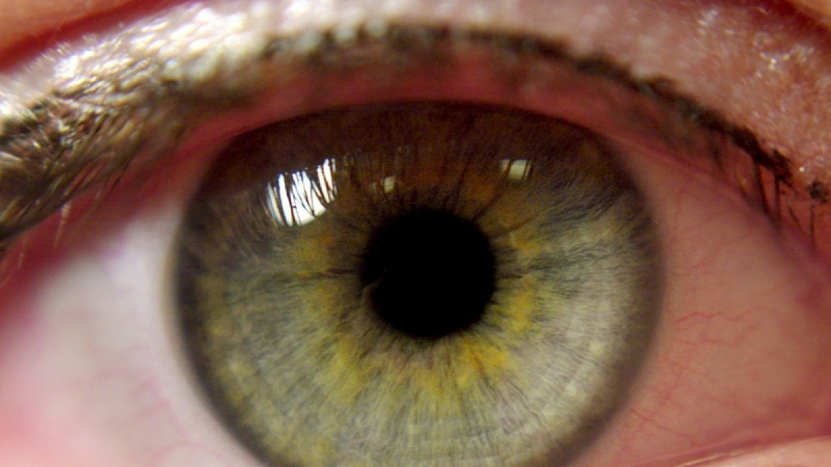 Beheizte R&auml;ume, Computer-Arbeit und Zigarettenqualm: Faktoren, die trockene Augen f&ouml;rdern. (Foto)
