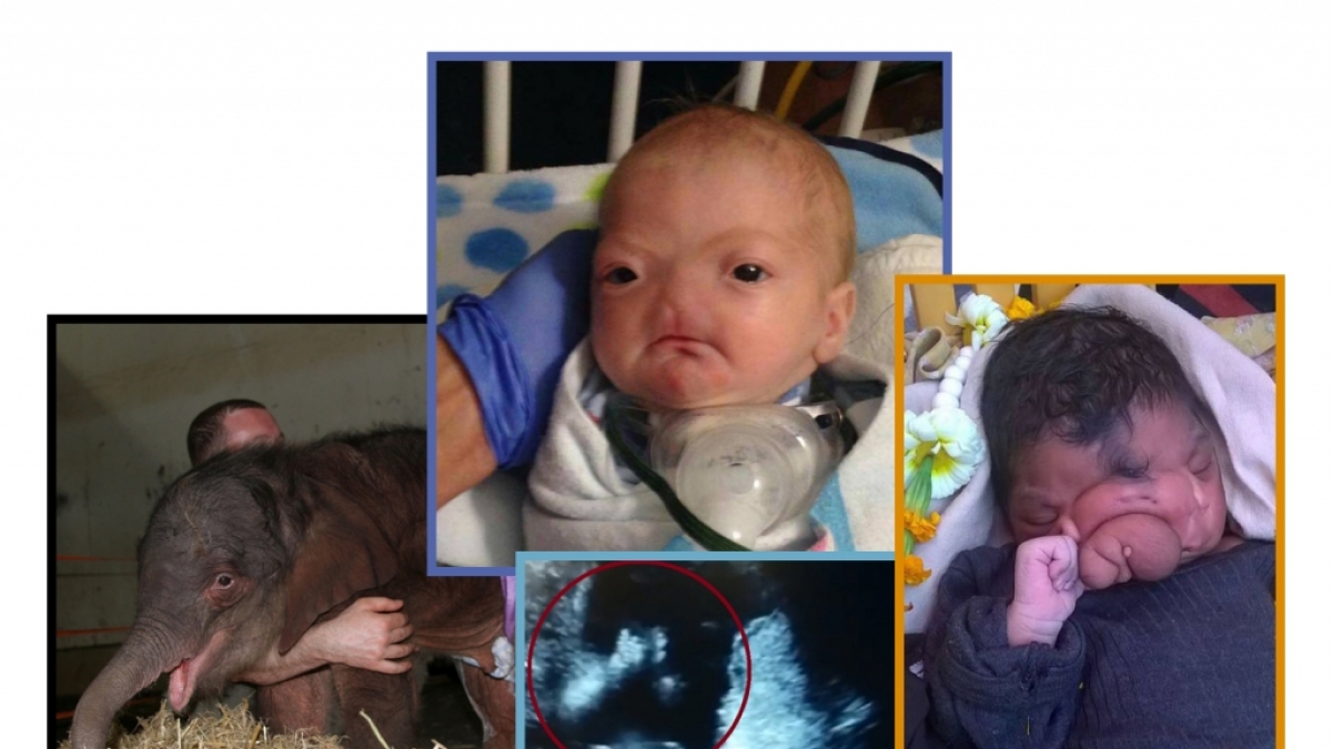 Diese Baby-Schicksale bewegten uns in dieser Woche. (Foto)