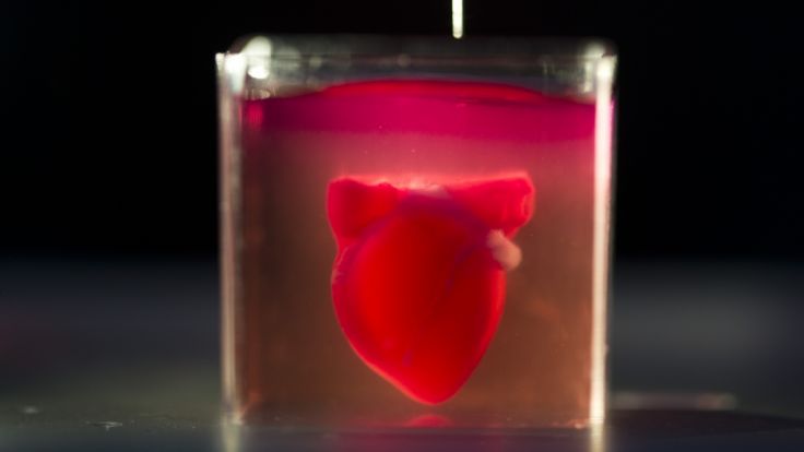 Erstes Herz aus 3D-Drucker