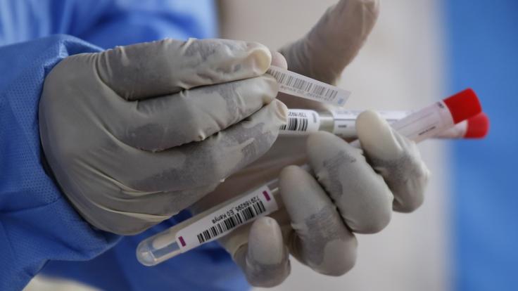 Woher nahm das Coronavirus seinen Ursprung?