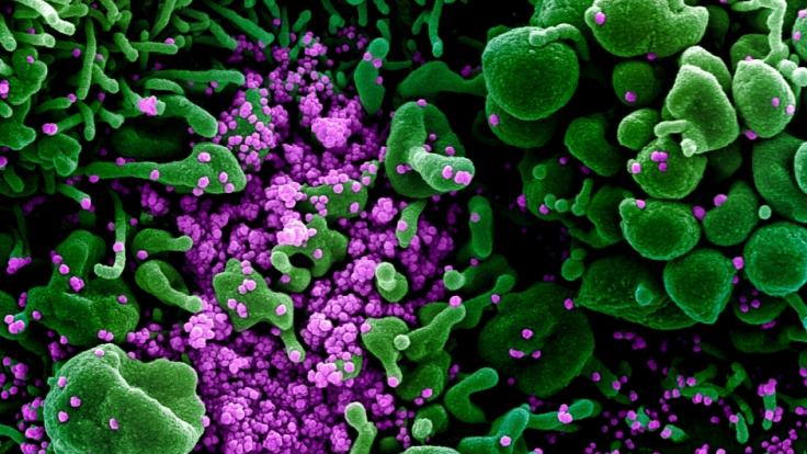 In Venezuela soll ein Mittel entdeckt worden sein, das das Coronavirus angeblich zu 100 Prozent unschädlich machen kann.