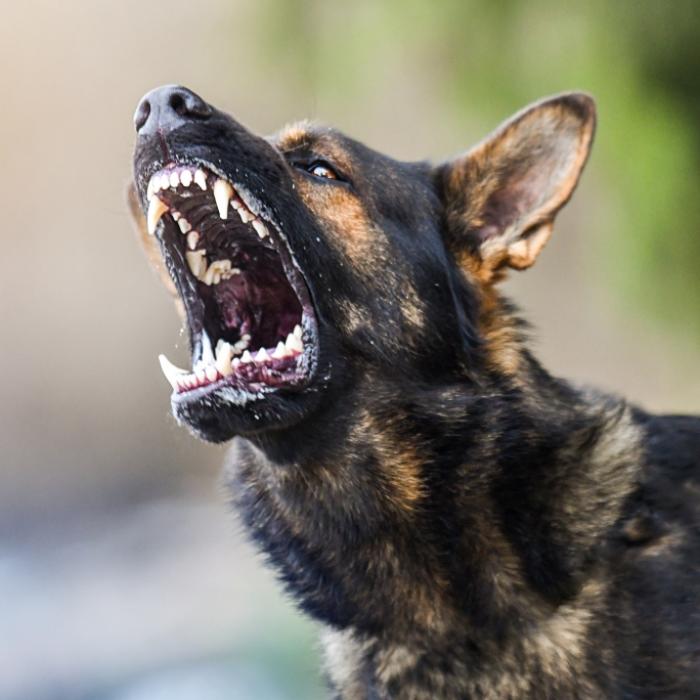 Hunde-Attacke lässt Influencerin entstellt und ohne Nase zurück