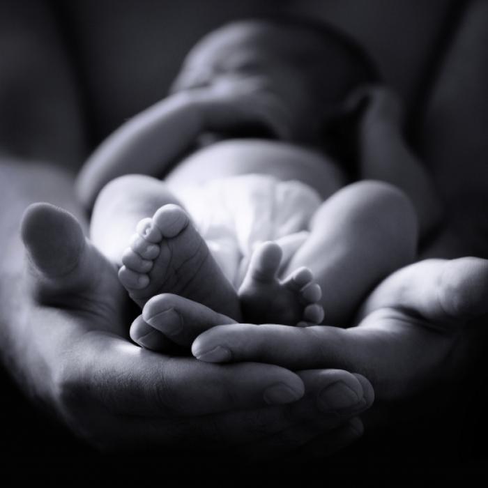 Baby mit zwei Köpfen und drei Armen sorgt für Aufsehen