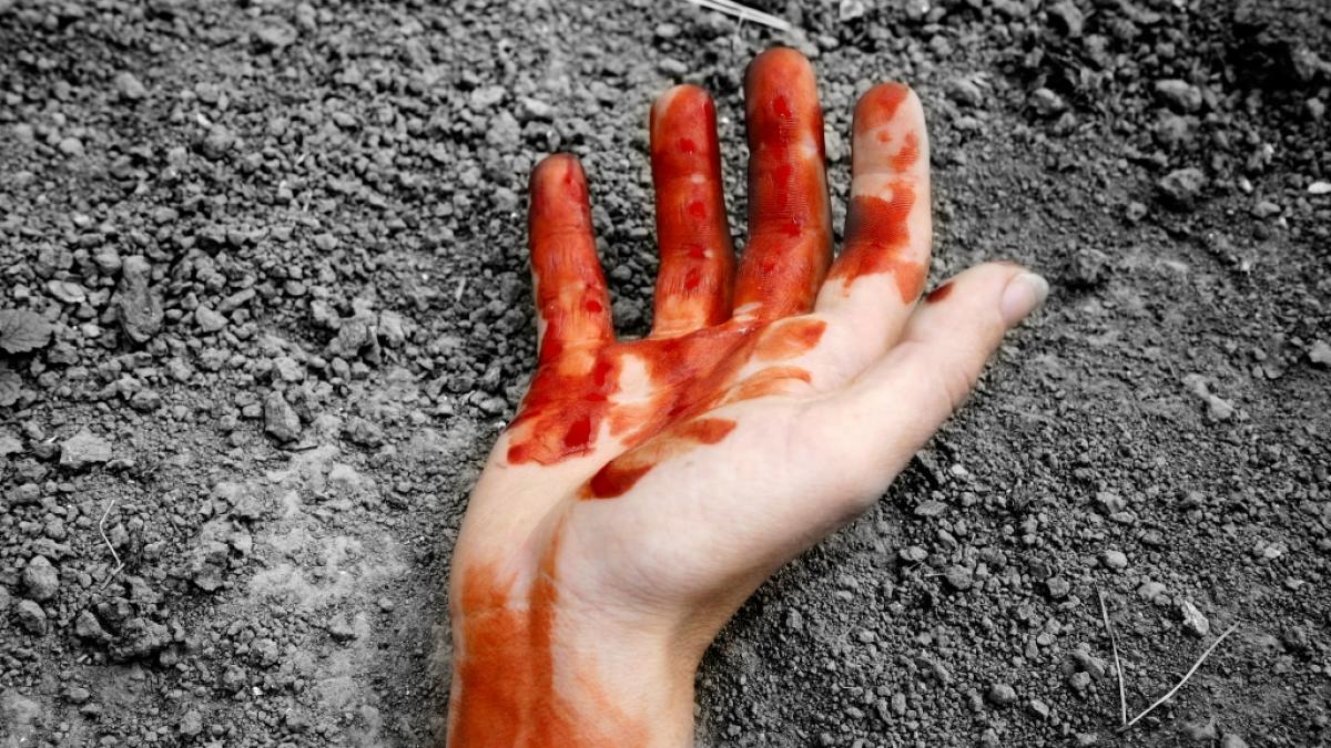 Ein nackter Mann mit einer abgetrennten Hand sorgte im englischen Grimsby f&uuml;r Aufruhr (Symbolbild). (Foto)