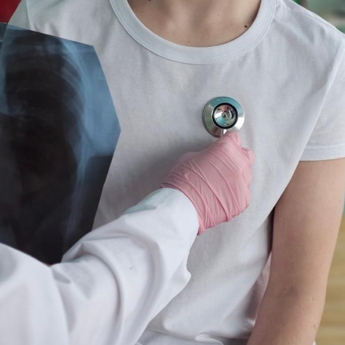 Tuberkulose-Gefahr steigt - resistente Stämme breiten sich aus