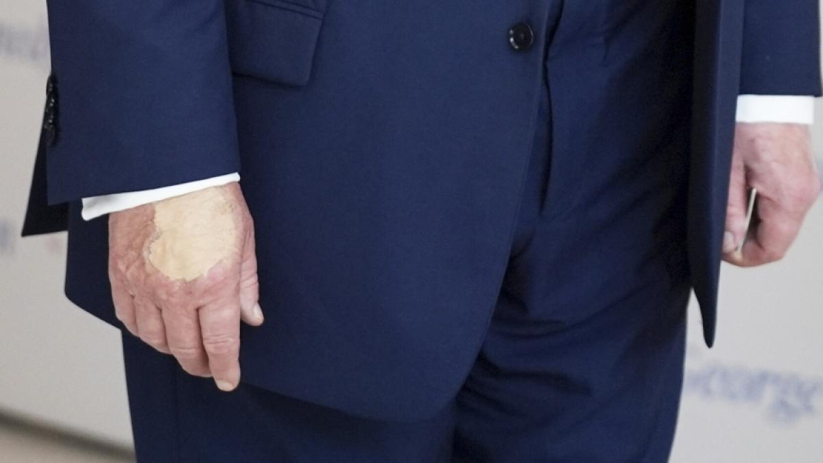Donald Trump sorgt mit seiner auff&auml;lligen Hand einmal mehr f&uuml;r Schlagzeilen. (Foto)