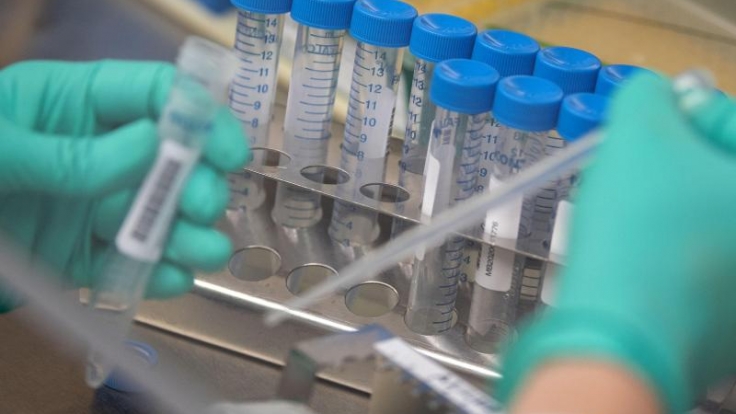 Bei vielen Infektionskrankheiten sind Genesene einige Zeit vor dem Erreger geschützt. Ob das auch für Sars-CoV-2 gilt, ist noch nicht abschließend erforscht