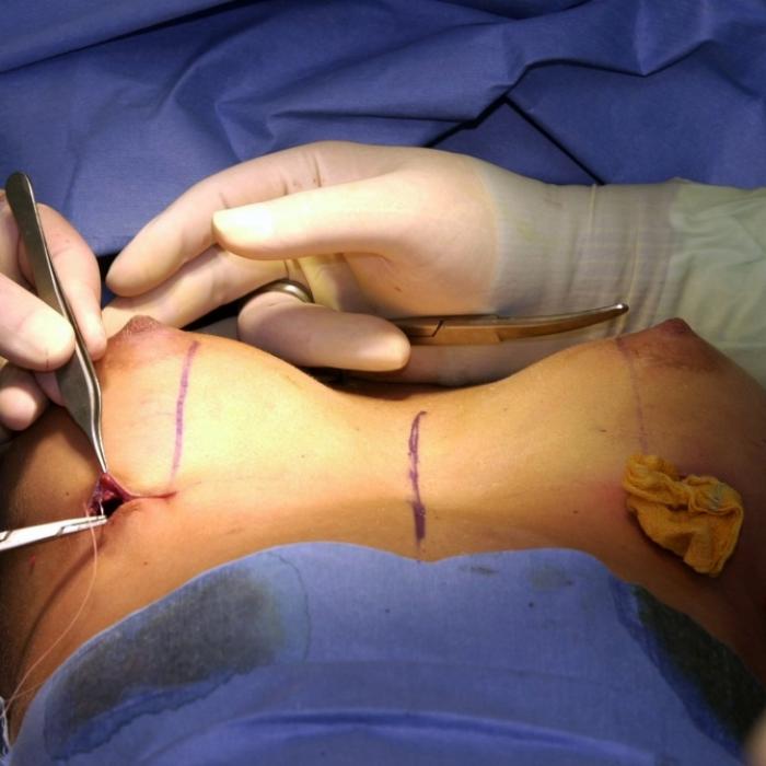 Schiefe Nippel, Loch in Pobacke! Russin grausam entstellt