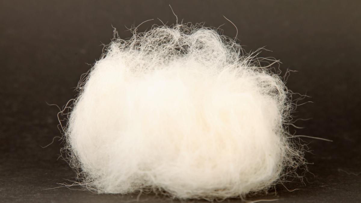 Einer 17-j&auml;hrigen Inderin wurde ein 7 Kilo schwerer Haarball entfernt. (Symbolbild) (Foto)