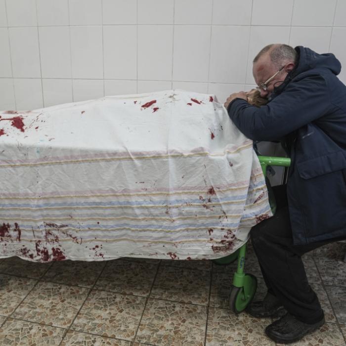 Vater beweint zu Tode gebombten Sohn - DIESES Bild rührt zu Tränen