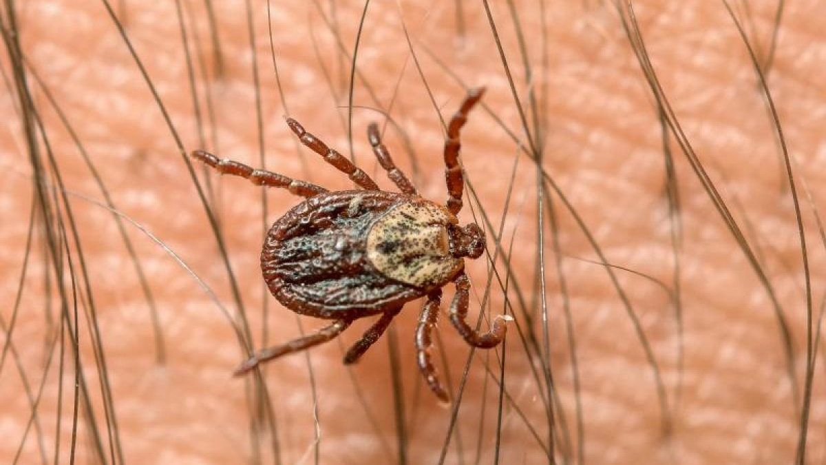 Wer sich in der Natur aufgehalten hat, sollte seinen K&ouml;rper immer auf Zecken kontrollieren. (Foto)
