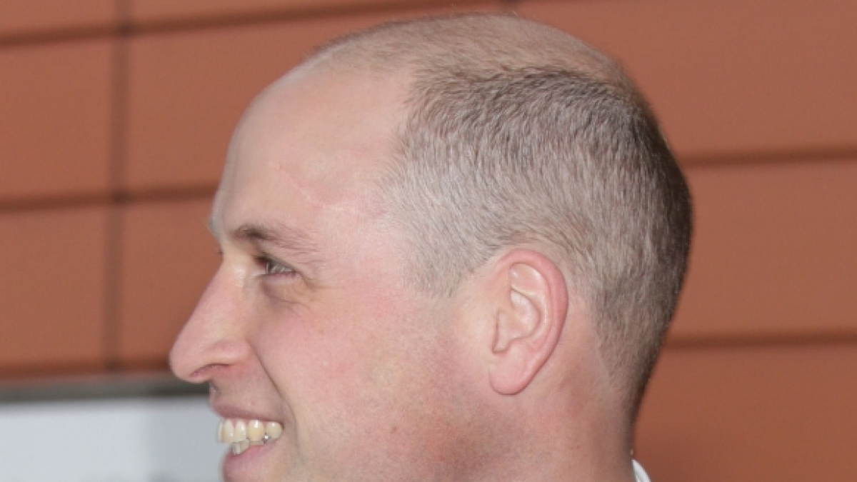 Seitlich hat der Prinz noch Haare. Welche er sich auf wenige Millimeter stutzte. (Foto)