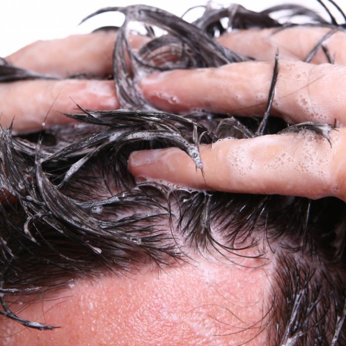 Anti-Schuppen-Shampoos mit fragwürdigen Inhaltsstoffen! Diese Produkte schmieren ab
