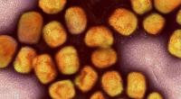 Eine mikroskopische Nahaufnahme des Mpox-Virus.