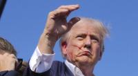 Donald Trump wurde bei dem Attentat am Ohr verletzt.
