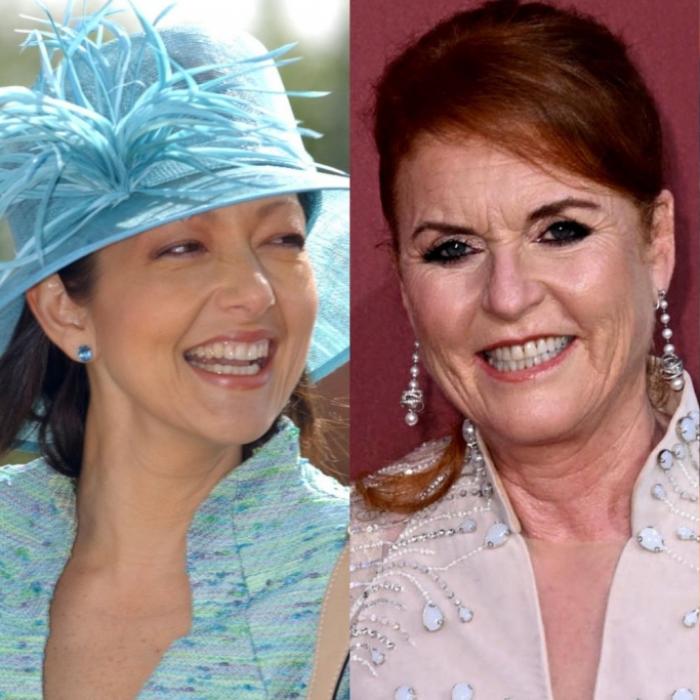 Diese Royals-Damen lagen schon beim Beauty-Doc unterm Messer