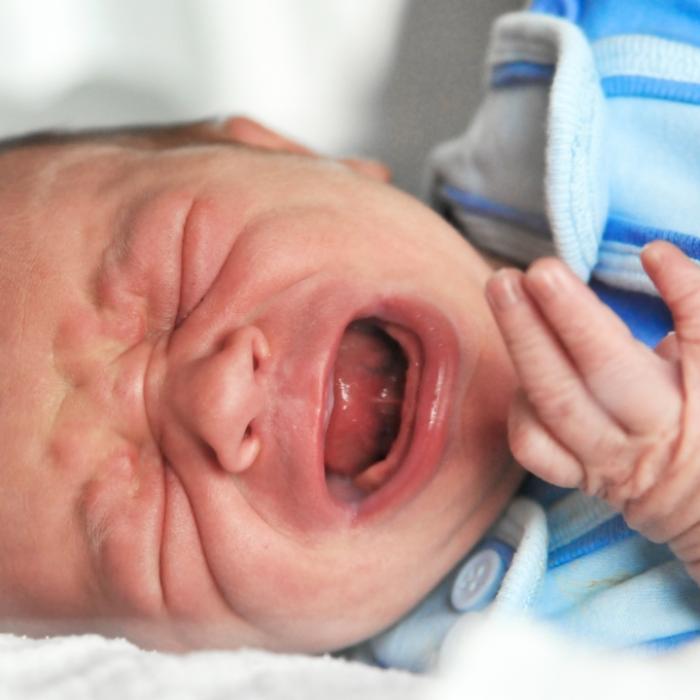 Mediziner verstümmeln Baby-Gesicht 