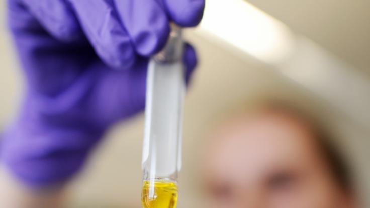 Hanta-Virus! Was ist das und welche Regionen sind gefährdet?