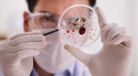 Experten warnen vor vier Erregern, die 2026 die Gesundheitslage negativ beeinflussen können.