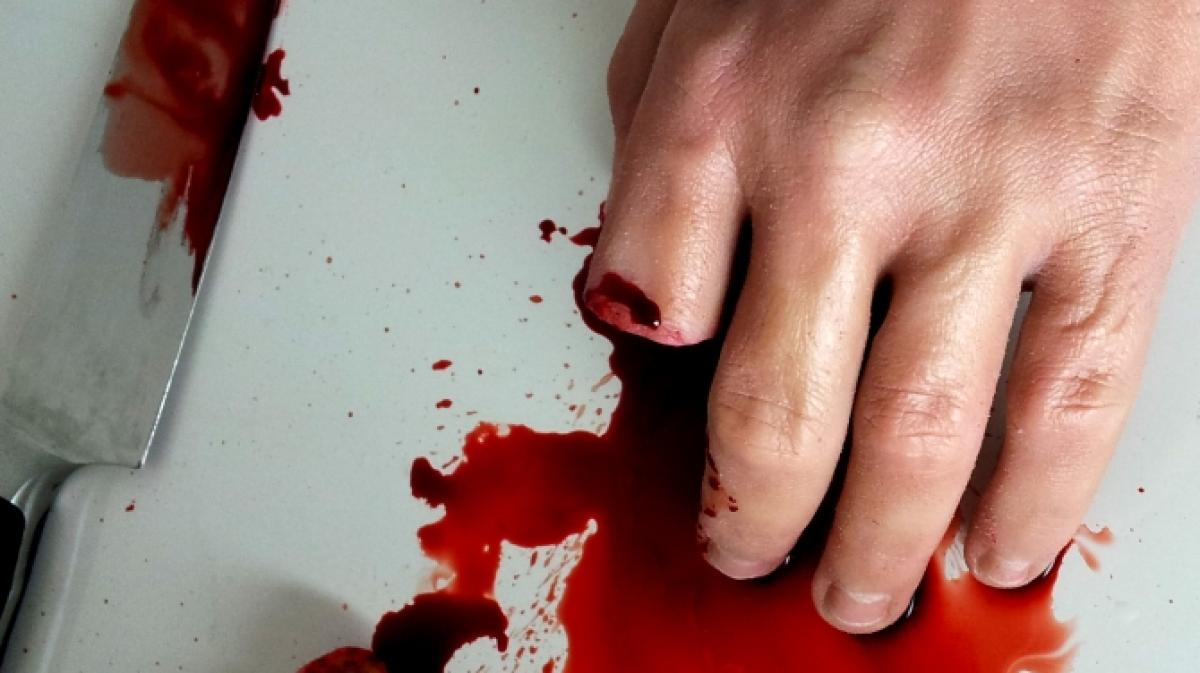 Lie&szlig; sich der angeblich von Linksradikalen attackierte Neonazi Alexander W. aus Chemnitz in Wahrheit freiwillig die Finger abschneiden? (Symbolbild) (Foto)