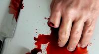 Ließ sich der angeblich von Linksradikalen attackierte Neonazi Alexander W. aus Chemnitz in Wahrheit freiwillig die Finger abschneiden? (Symbolbild)