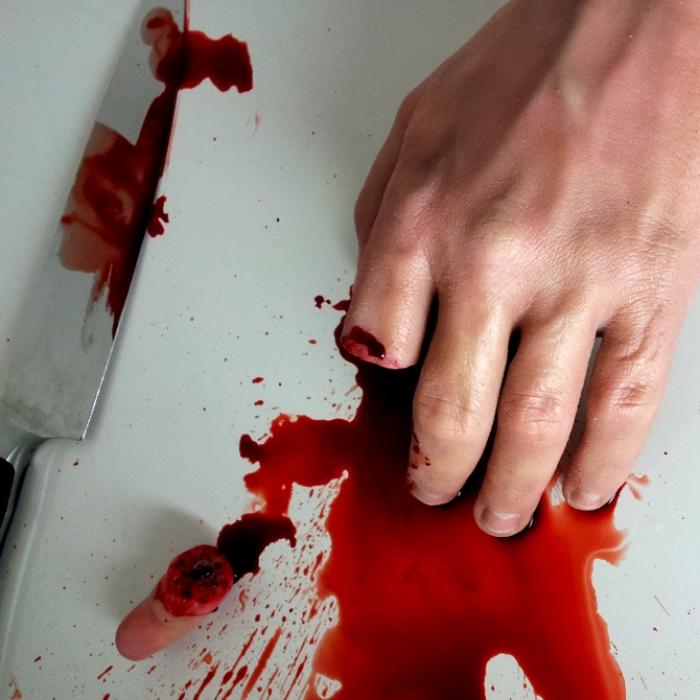 Finger freiwillig abgehackt? Linker Macheten-Angriff womöglich nur vorgetäuscht