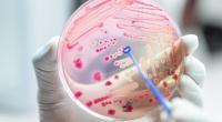 Bakterien unter der Lupe: Antiobiotikaresistenzen stellen die Medizin vor ein immer größeres Problem.