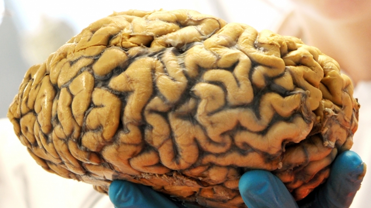 Ein Wissenschaftler h&auml;lt am 21. Februar 2013 im Institut f&uuml;r Anatomie der Universit&auml;t Leipzig (Sachsen) ein menschliches Gehirn in seiner Hand. (Foto)