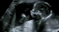 Eine 35-jährige Influencerin aus Russland erwartet nach der Hochzeit mit ihrem einstigen Stiefsohn ein Baby (Symbolbild).