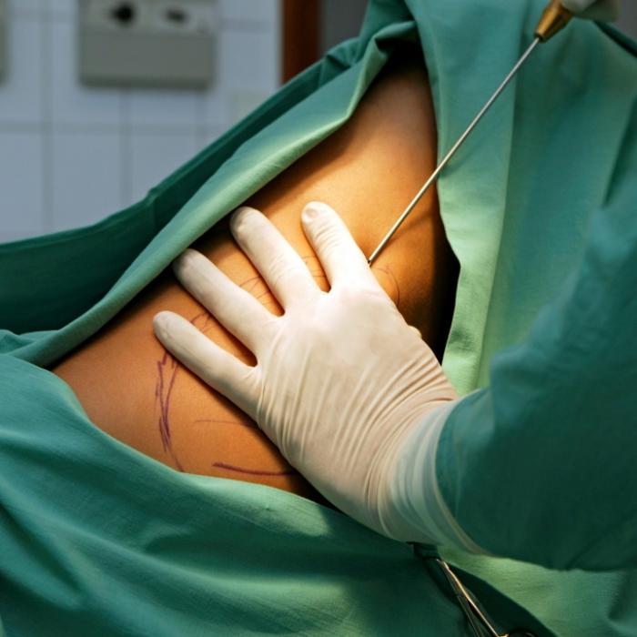 Indischer TV-Star (21) gestorben! Herzstillstand nach Beauty-OP