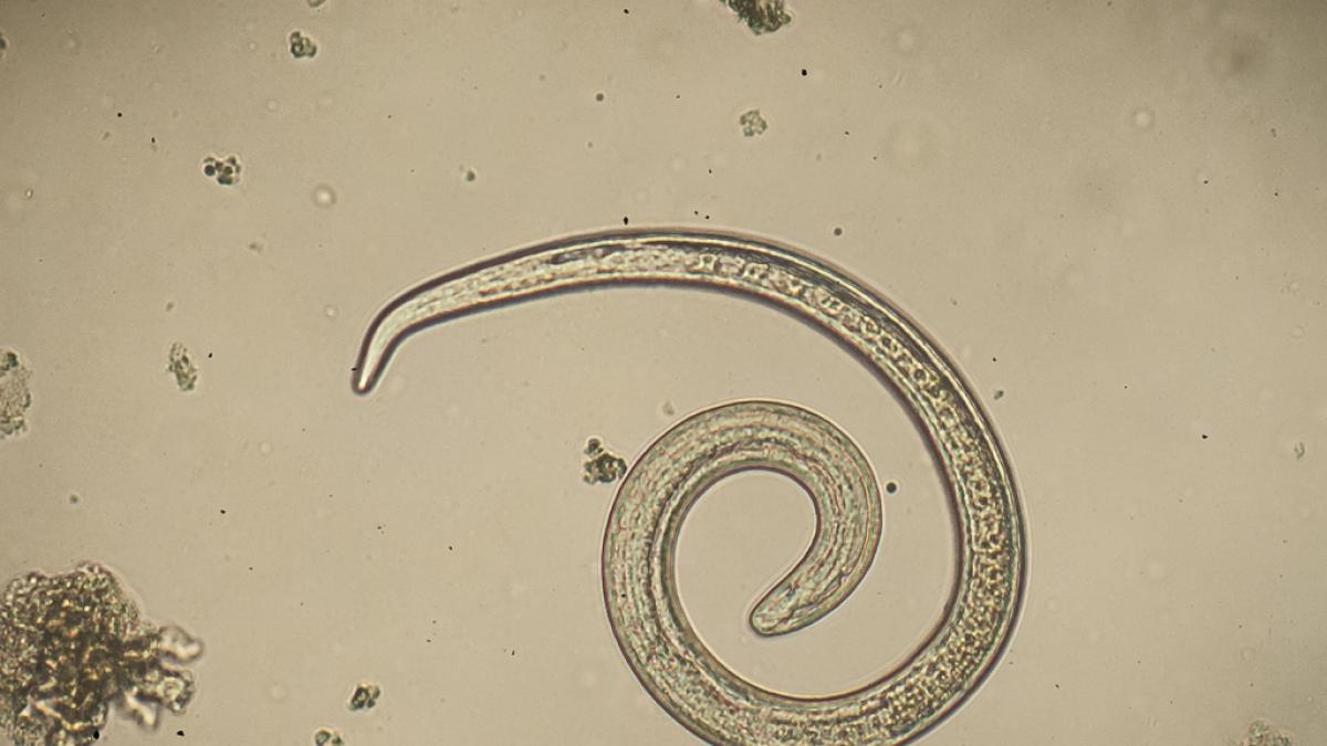 Parasiten in Lebensmitteln k&ouml;nnen krank machen. (Foto)
